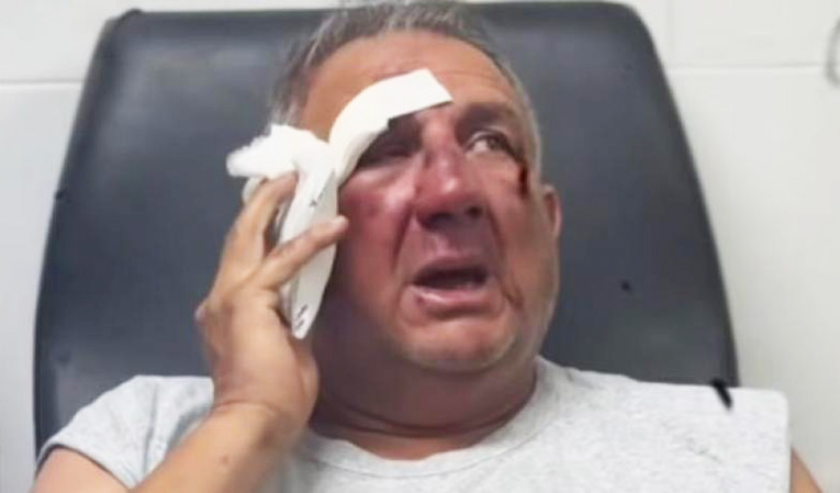 Ataque salvaje a un taxista en el sur tucumano: fue estrangulado con un cable y le robaron el vehículo