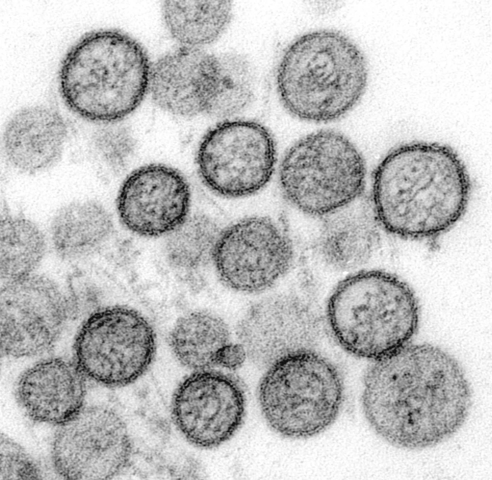Ya son 47 los casos de hantavirus en Argentina en lo que va de 2026