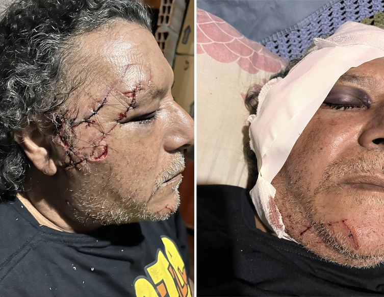 Brutal ataque a un padre y su hijo cuando iban a trabajar: la inseguridad vuelve a golpear en Tucumán