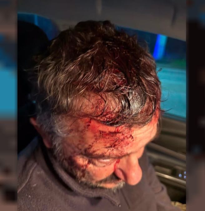 Tucumán: Balearon al dueño de la Aerosilla Nuevo Cadillal frente a su familia
